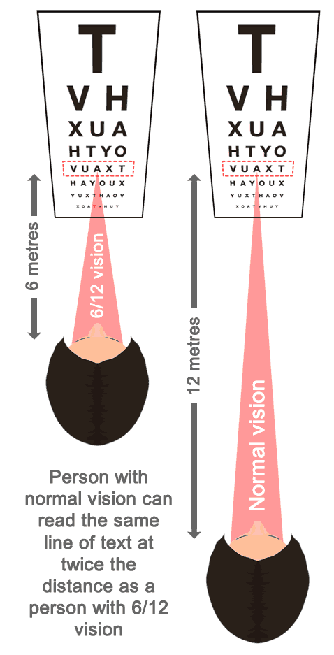 The meaning of 6/12 eyesight explained